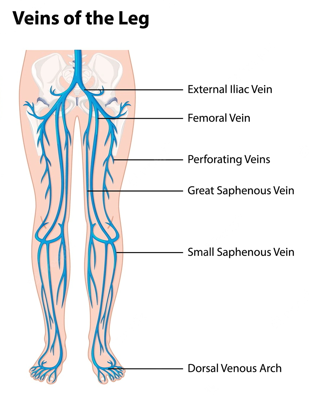 leg pain illustration veins