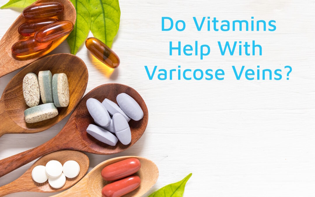 Do Vitamins Help With Varicose Veins?